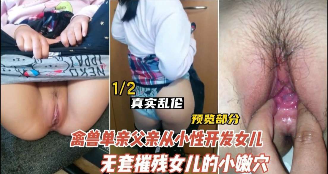 图片丢失或加载异常